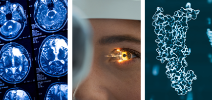 Critical Imaging Risks In GLP-1 And Neurology Studies: What You Need To Know Critical Imaging Risks In GLP-1 And Neurology Studies: What You Need To Know