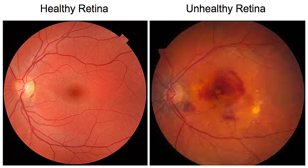 Most Common Eye Diseases